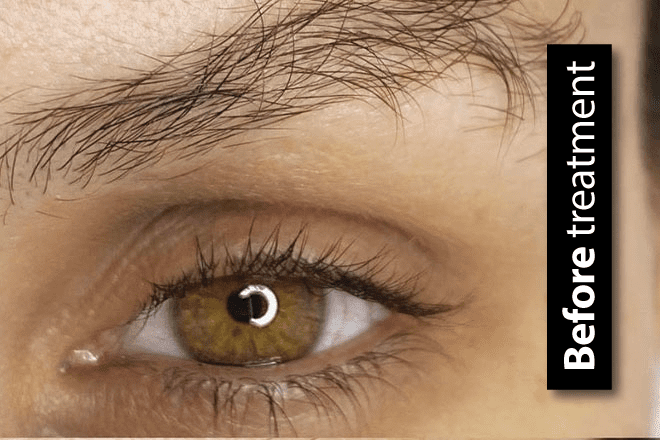 Lash & Brow Lamination 2